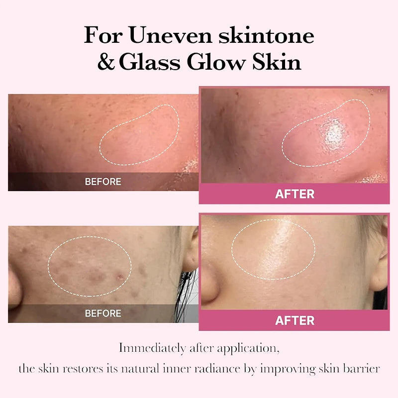 2025 Collagen Jelly Cream – Whitening & Brightening Moisturizer