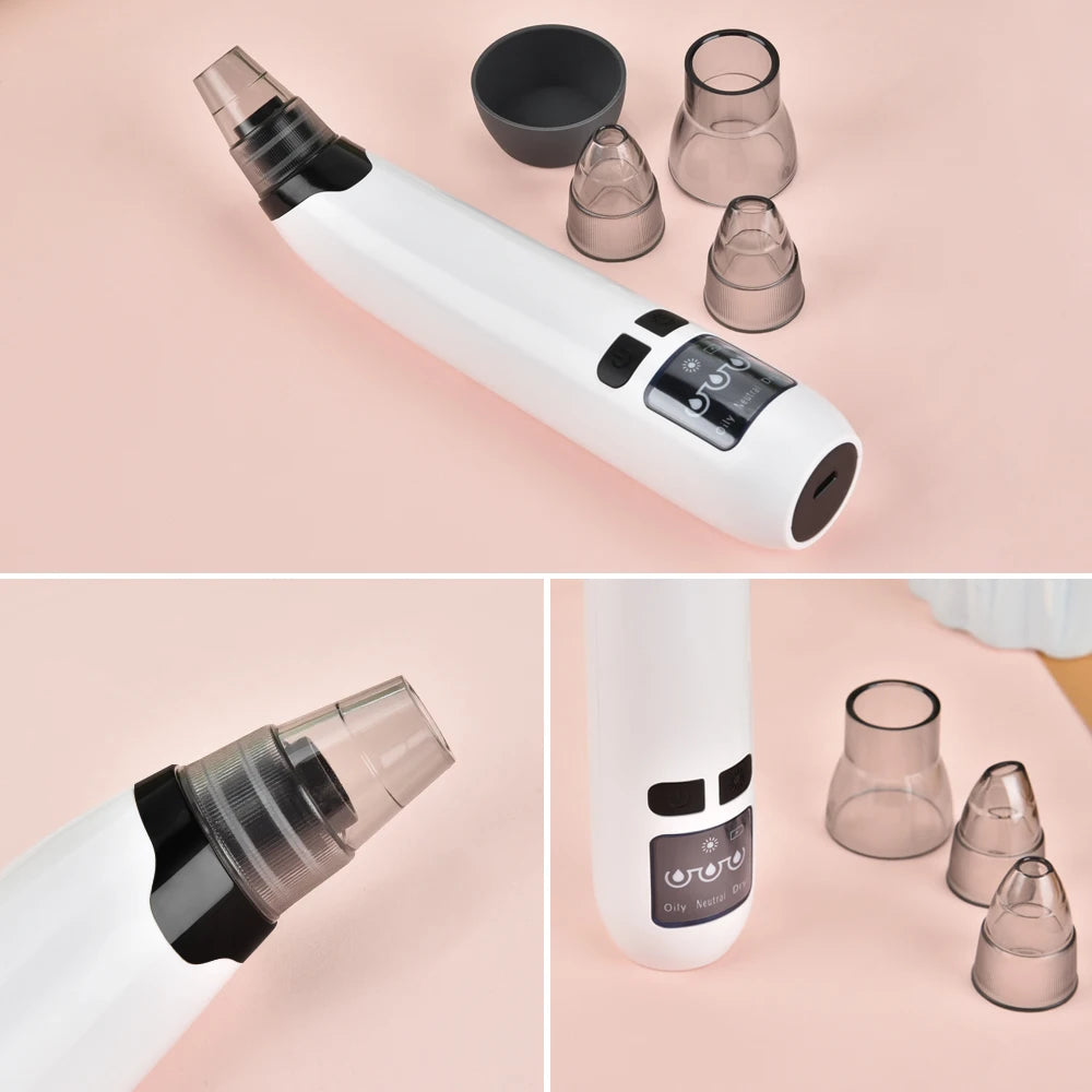 Electric Blackhead Remover