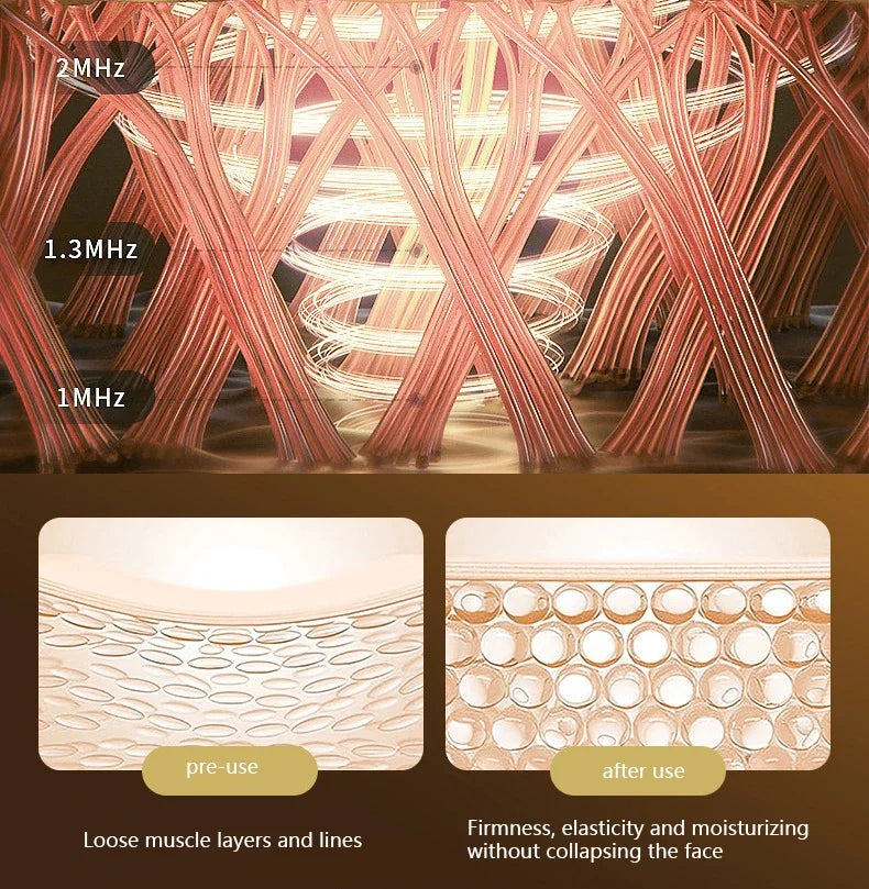 Neck & Face Lifting Device