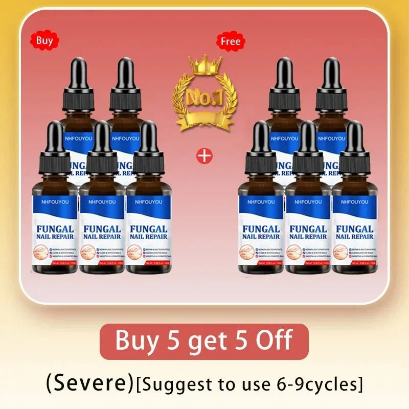 Fungal Nail Treatment Essence & Laser Device
