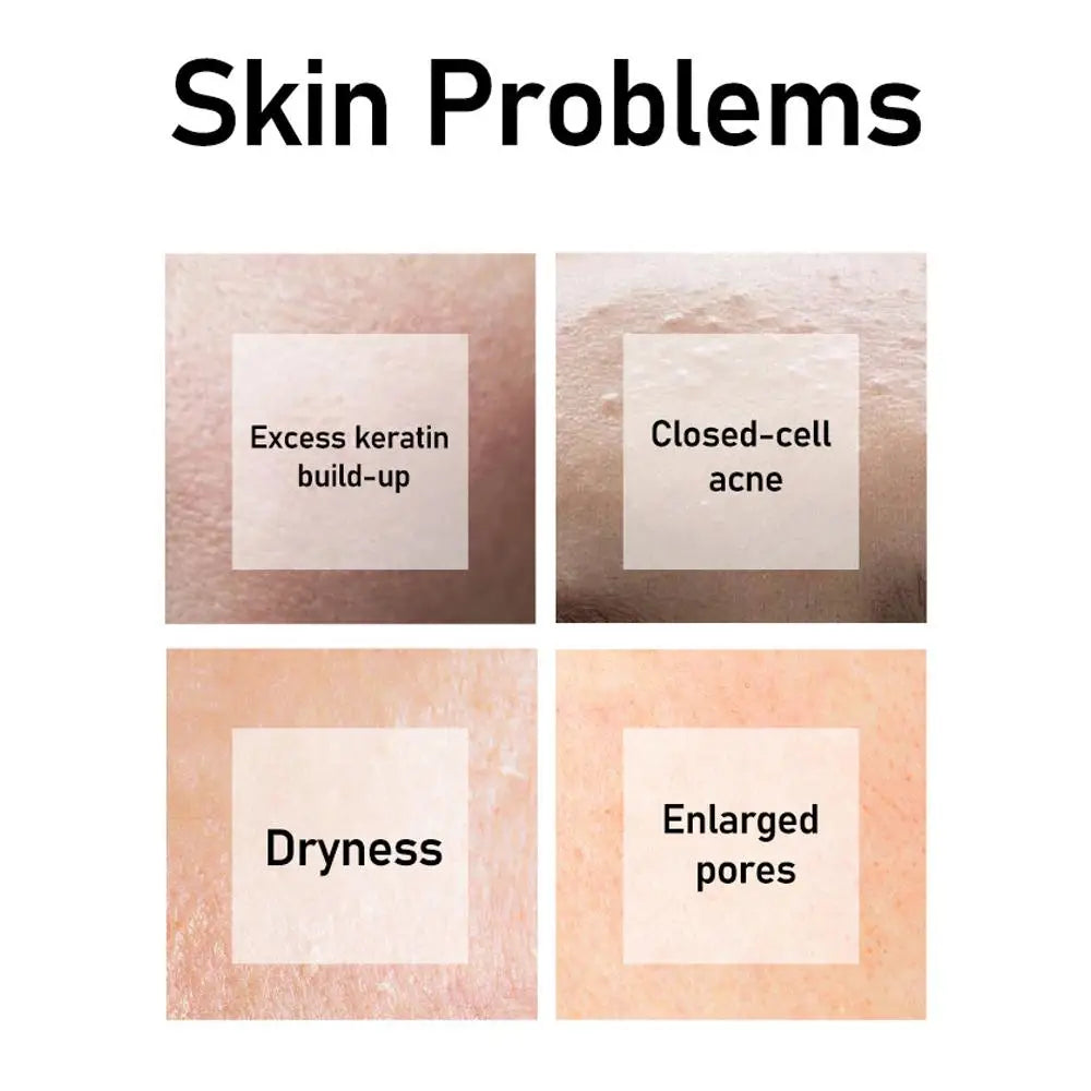 AHA 30% + BHA 2% Salicylic Acid Facial Essence